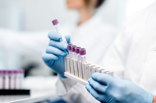 В Азербайджане выявлены 137 новых случаев инфицирования COVID-19, скончались еще два человека - ФОТО