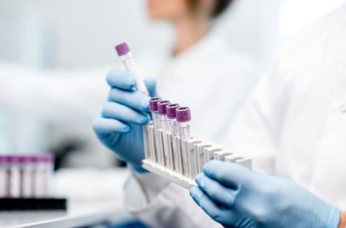 Azərbaycanda daha iki nəfər koronavirusdan öldü: 137 yeni yoluxma - FOTO