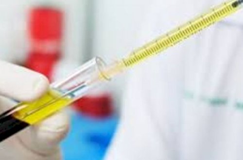 Koronavirus testləri haqda yeni təklif