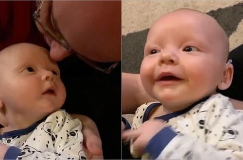 Eşitmə məhdudiyyətli uşağın ilk dəfə səs eşitdiyi anla bağlı təsirli VİDEO