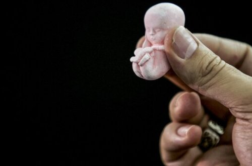 Həkimlə əlbir olub sevgilisini abort etdirdi - XAİN PLAN - VİDEO