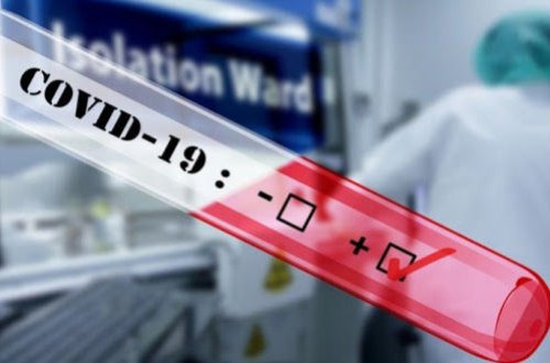 Dünyada koronavirusa yoluxanların sayı 26 milyonu keçdi - STATİSTİKA