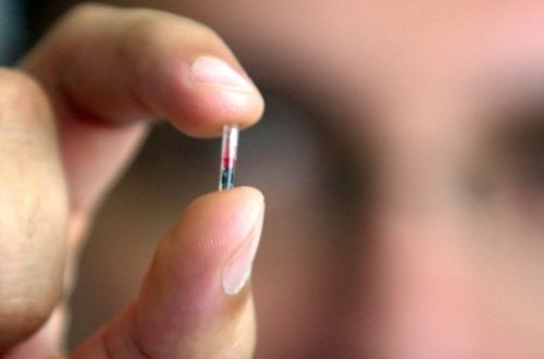 Azərbaycanda ilk çipləşdirmə: “Cəmiyyəti fəlakətə aparacaq”