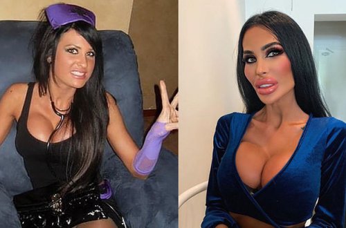 Медсестра пять раз увеличила грудь и разбогатела на эротических снимках - ФОТО