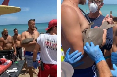 Qolunu köpəkbalığı dişləyən adam deyib-gülərək xəstəxanaya getdi - FOTO-VİDEO