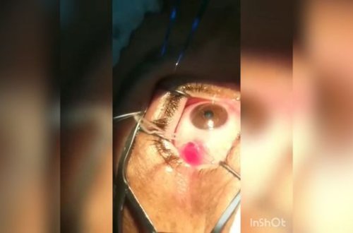 Azərbaycanda gözdən qurd çıxarıldı - VİDEO