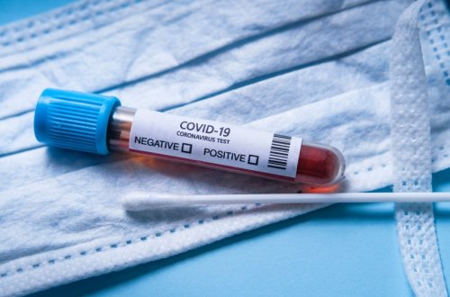 SON DƏQİQƏ! Azərbaycanda yoluxma yenidən artdı