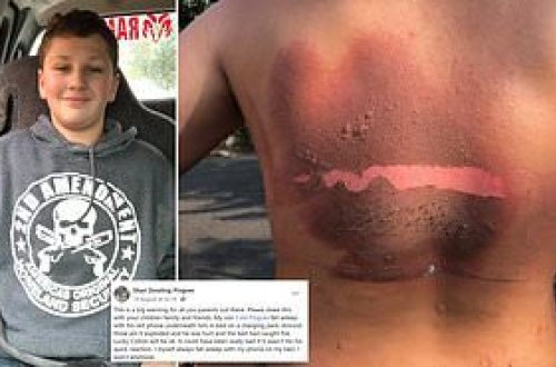 Telefonu şarja qoyub yuxuya gedən yeniyetmə BELƏ YANDI - FOTO+18