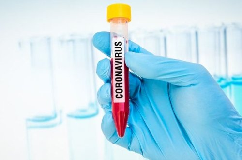 İranda bir gündə 117 nəfər koronavirusdan öldü