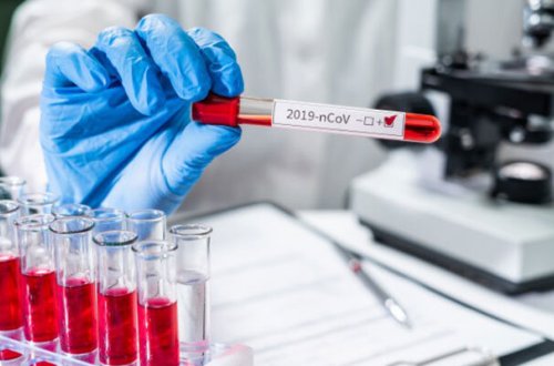 В Азербайджане выявлены 175 новых случаев инфицирования COVID-19, скончались еще три человека - ФОТО