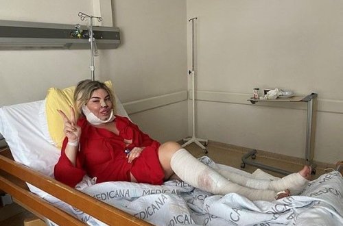 Kişi özünü “Barbi”yə oxşatmaq üçün əməliyyat keçirdi - FOTO