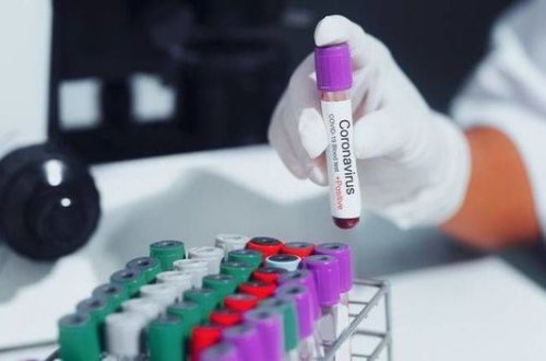 Число вылечившихся от коронавируса в мире превысило 20 млн