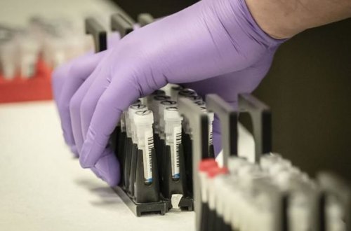 Azərbaycanda koronavirusa yoluxmada müsbət dinamika: Sağalanların sayı artdı - FOTO