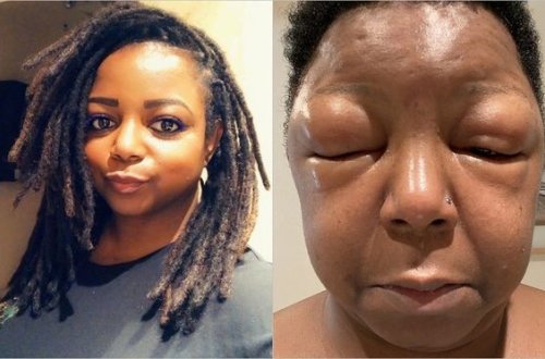 Ev şəraitində saçlarını boyayan qadın güzgüyə baxanda şoka düşdü - FOTO