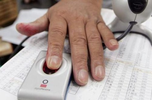 Barmaq izi olmayan gənc hər kəsi təəccübləndirdi - FOTO