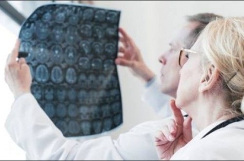 Доказан разрушительный вред коронавируса для мозга