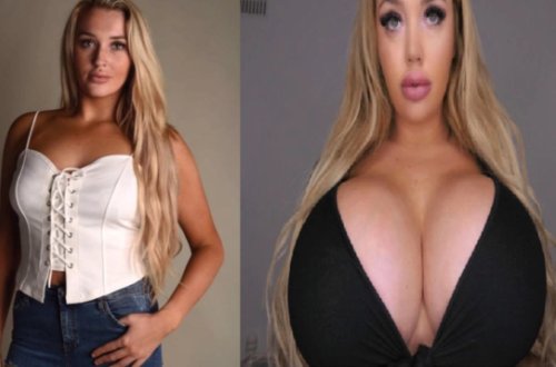 Sinəsini anormal dərəcədə böyüdüb ZƏNGİNLƏŞDİ - FOTO