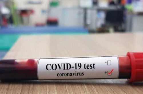 Azərbaycanda yoluxanların sayı yenə artdı - FOTO