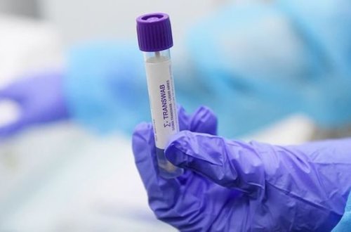 В Азербайджане выявлены 163 новых случая инфицирования COVID-19, скончался еще один человек - ФОТО