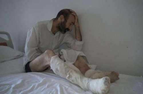 Özünü yandıran Qarabağ döyüşçüsünün fəryadı: “İstəmirəm ki, kiməsə zülm verim” - VİDEO