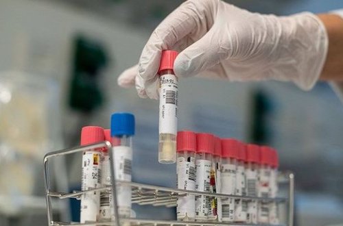 Число вылечившихся от коронавируса в мире превысило 21 млн