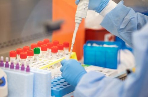 Azərbaycanda daha üç nəfər koronavirusdan öldü: 141 yeni yoluxma - FOTO