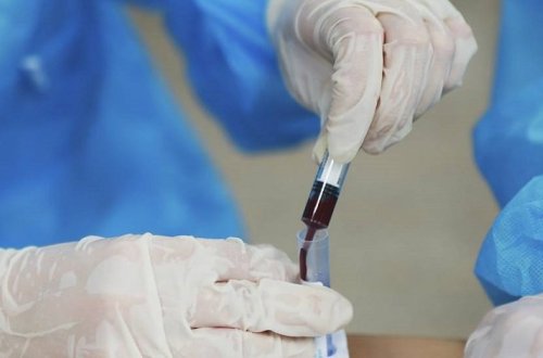 Ученые разрабатывают лекарство от коронавируса на основе антител лошадей