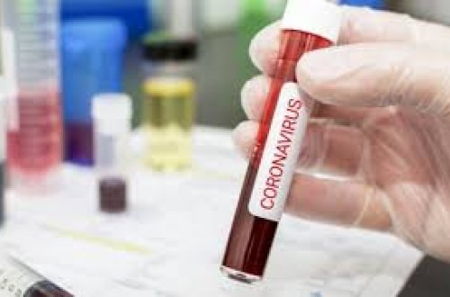 Bu gün Azərbaycanda neçə nəfər koronavirusa yoluxdu? - RƏSMİ