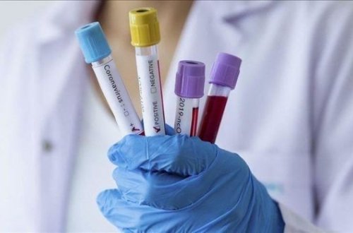 Обнародована последняя мировая статистика по коронавирусу