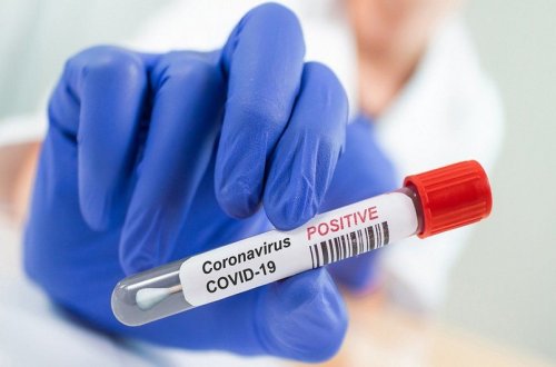 Azərbaycanda koronavirusa yoluxanların sayı azaldı - RƏSMİ