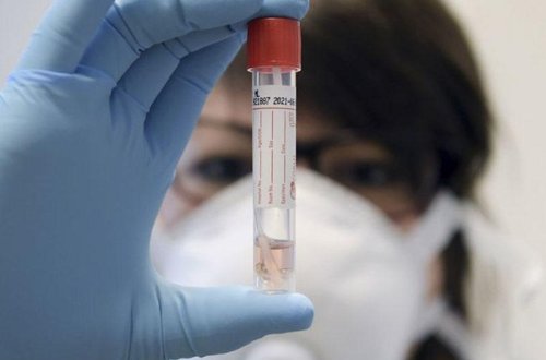 Bu məktəbdə 8 müəllim koronavirusa yoluxdu, tədris dayandırıldı - Azərbaycanda