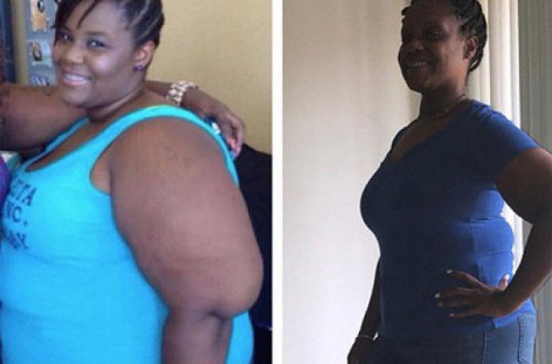 157-килограммовая женщина похудела на 64 килограмма и раскрыла секрет успеха - ФОТО