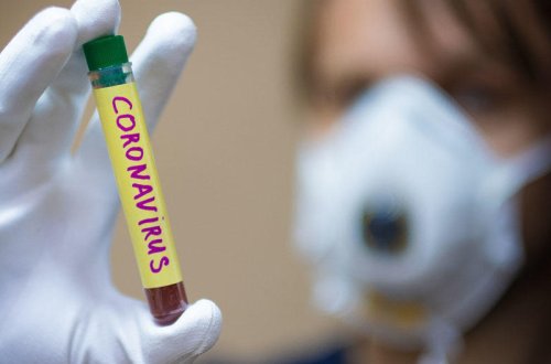 Dağlıq Qarabağda COVID-19-a yoluxanların sayı 385 nəfərə çatıb