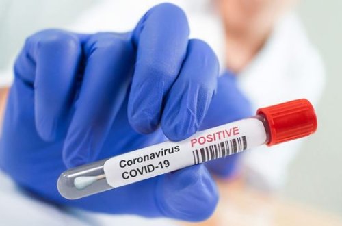 Azərbaycanda daha 19 şagird koronavirusa yoluxdu - RƏSMİ