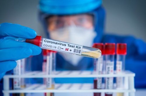 Azərbaycanda koronavirusa yoluxanların sayı sağalanları üstələdi: Bir nəfər öldü - FOTO