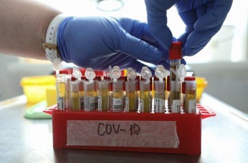 Koronavirusun ikinci dalğasının əsas göstəriciləri açıqlandı