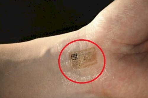 Azərbaycanda insanlar çipləşəcək? – TƏBİB-dən açıqlama + Video