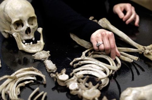 Cərrah gizli şəkildə insan sümüklərindən kolleksiya toplayıb