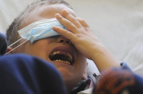 Kompüter tomoqrafiyasından keçən pasiyentlər yanıq xəsarəti aldılar