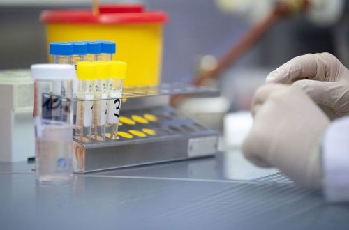 Назван фактор, ослабляющий иммунитет к коронавирусу