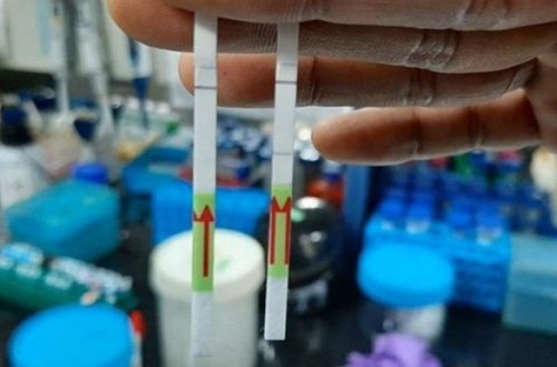 В Индии разработали первый в мире бумажный тест на COVID-19