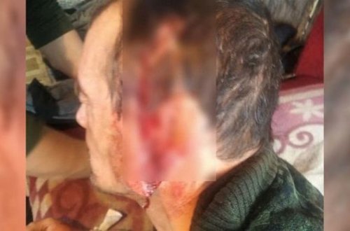 Ağ ayının hücumuna məruz qalan kişi sağ qaldı