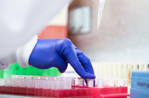 Azərbaycanda daha bir nəfər koronavirusdan öldü: 191 yeni yoluxma - FOTO