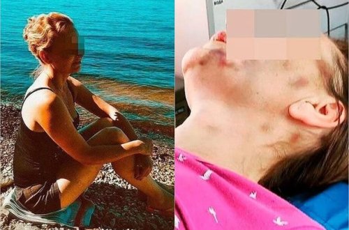 Boşanmaq istəyən arvadını evə bağlayıb, bir ay ac saxladı - FOTO/VİDEO