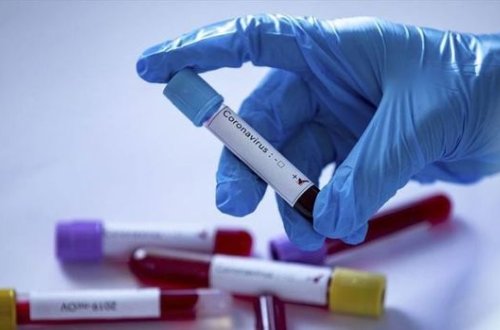 Koronavirusla bağlı SON STATİSTİKA