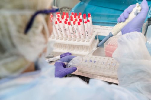 Azərbaycanda daha üç nəfər koronavirusdan öldü: 277 yeni yoluxma - FOTO