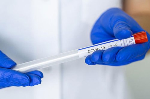 Koronavirusa yoluxanların sayı 530-a çatdı - GÜNÜN STATİSTİKASI