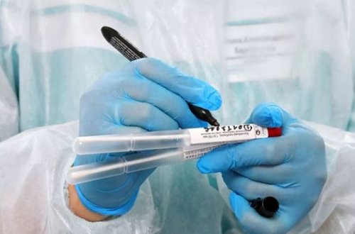 Özəl klinikalarda koronavirus testlərinin qiymətləri endirilə bilər? - AÇIQLAMA