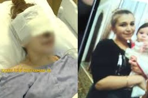 Gəncə terrorunda gözlərini itirən Pərvin: 