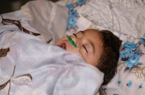 Bərdənin raket atəşinə tutulması nəticəsində yaralananlardan dördü azyaşlıdır - FOTO